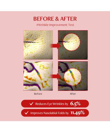 MEDITHERAPY Shumage Shot Gold Seal Lifting Ampoule - Anti-Wrinkle Gold Threads & Collagen Serum for Radiant Skin | Korean Skincare 0.4 fl. oz - Buy Online on GoSupps.com
