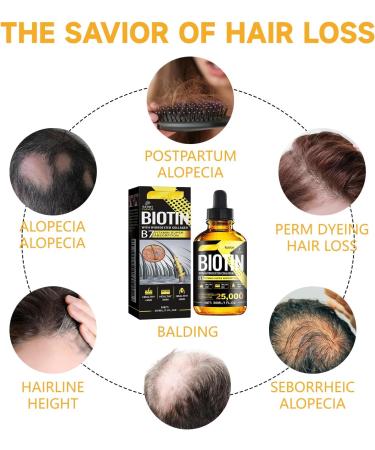  MagiSel Anti Hair Loss Lotion Men Women 30ml Essence for Hair Growth Fast Growth Hair Treatment Hair Growth Serum Anti Hair Loss for Women - Buy Online on GoSupps.com