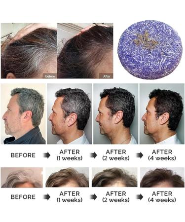 COALHO Shampoo Bar Hair Darkening Shampoo Bar Shampoo And ConditionerShampoo Soap Organic Shampoo Bar Shampoo Bar For Hair Growth 3 pieces - Buy Online on GoSupps.com