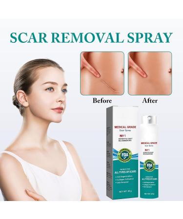 PARHAR Advanced Scar Repair Spray: For Facial Acne, Dark Spots, Surgical Scars, Stretch Marks - Gently Cares for Acne-Prone Skin, Relieves Itching - Suitable for All Scar Types - Buy Online on GoSupps.com