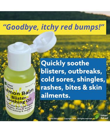 Urban ReLeaf Lemon Balm - Fast Relief for Blisters, Rashes, Bumps, and Bug Bites | 100% Natural | Made Fresh in the USA - Buy Online on GoSupps.com