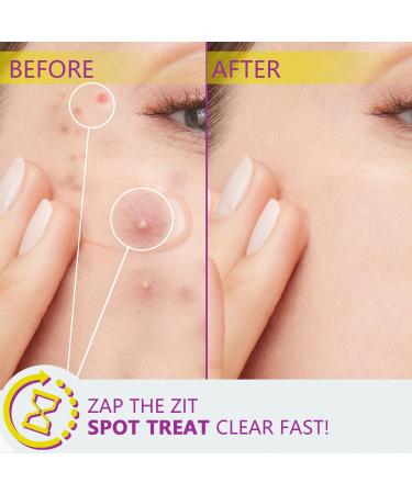 Azelaic Acid 12% Azelaic Acid For Face Serum Rich in Niacinamide and Hyaluronic Acid Fades Post Acne Marks and Calms Redness Formula for Uneven and Blemish Prone Skin Care Unflavored - Buy Online on GoSupps.com
