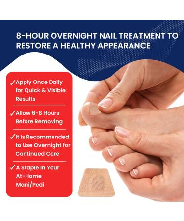 Extra Strength Multi-Purpose Fungus Nail Patches | Effective Toenail & Ingrown Toenail Treatment | Nighttime Fungal Nail Solution - Buy Online on GoSupps.com
