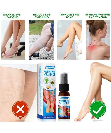 2 Pieces Veinhealing Varicose Vein Treatment Spray | Soothing Relief for Legs | Effective Varicose Vein Spray - Buy Online on GoSupps.com