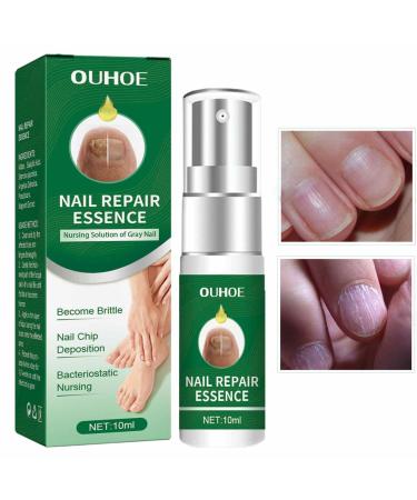FASSME Nail Repair Essence toenail solution nail repair nursing solution of gray nails safe and effective repair discolored damaged nails 10ml