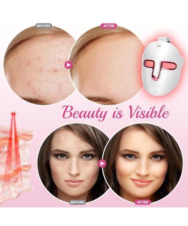Zupora Red Light Therapy Mask - 7 Color LED Face Rejuvenation & Skin Care | International Shipping - Buy Online on GoSupps.com