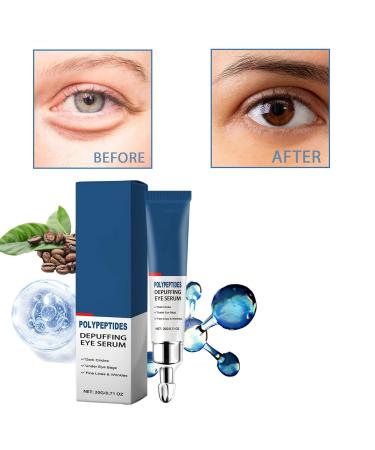 Seurico & Himeye Peptide Depuffing Eye Serum Duo - Moisturizing Gel for Dark Circles Under Eye Bags Puffiness Fine Lines & Wrinkles | International Shipping - Buy Online on GoSupps.com