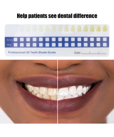 Tooth Color Chart - Professional Teeth Whitening Shade Scale for Home & Travel | Compact Dental Tool - Buy Online on GoSupps.com