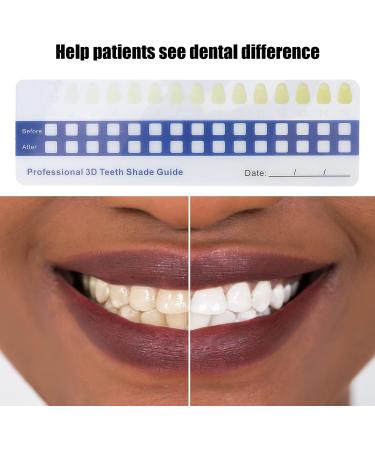 Professional Tooth Whitening Color Guide - 5-Part Comparison Card for Home & Dental Use - Buy Online on GoSupps.com