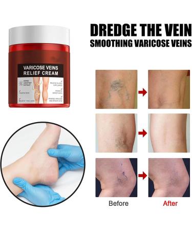 3-Pack Krampfade Cream for Legs | Varicose Veins Relief | All Skin Types | Arm & Feet Care - Buy Online on GoSupps.com