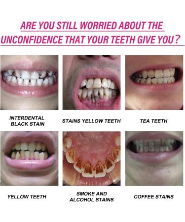 Mint Tooth Powder Crystalclean Smile Powder Crystalclean Tooth Powder Teeth Whitening Powder for Tooth Whitening 7 Days Tooth Cleaning Powder Whitening (3pcs) - Buy Online on GoSupps.com