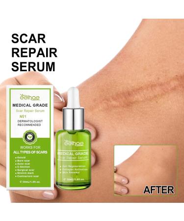 Goopgen Advanced Scar Repair Serum - Medical Grade Scar Removal Spray (90ml) - Buy Online on GoSupps.com