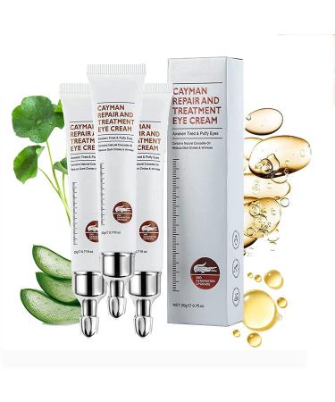 Axoeye Lifting Eye Gel Renew Peptide Lifting Eye Gel Vibrant Glamour Eye Cream Magic Eye Cream for Remove Eye Bags Wrinkles Fine Lines Dark Circles Puffiness Repairing & Moisturizing (3PCS)