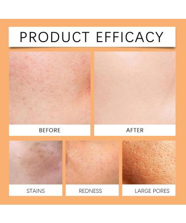 Nettoyant Visage Doux - Nettoie En Profondeur Les Pores Illumine La Peau Hydrate Et Exfolie Laisse La Peau Fra che (sans Effet Gras)(1PCS) 1 g (Lot de 1) - Buy Online on GoSupps.com