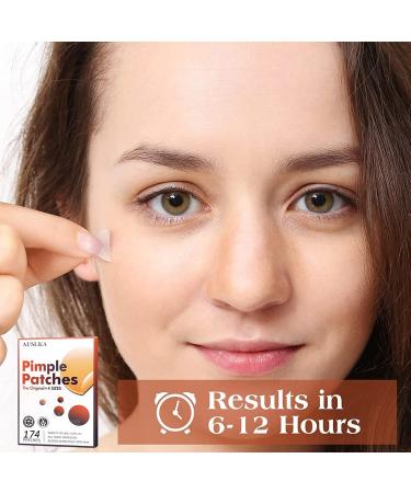 AUSLKA Pimple Patches (174 Patches) - Hydrocolloid Patches - Invisible Pimple Spot Stickers - Facial Stickers All Skin Types - Buy Online on GoSupps.com