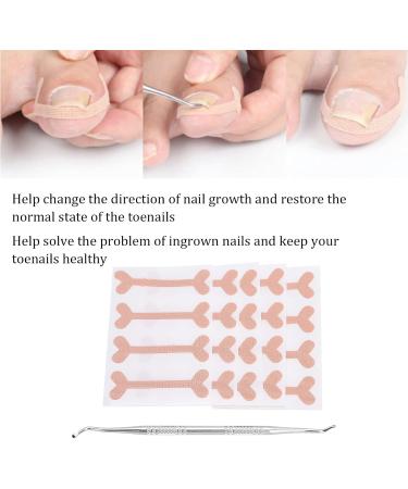 Ingrown Toenail Patch Nail Picker Pedicure Tool 20 Adhesive Stickers Toenail Correction Relief Prevention Suitable for Ingrown Thick Nails - Buy Online on GoSupps.com