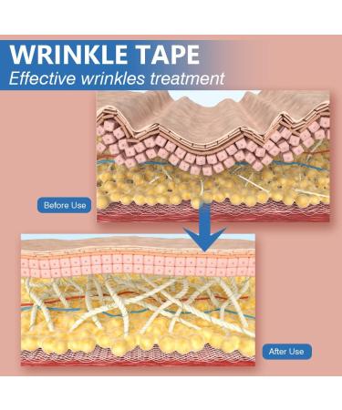 Face Lifting Tape - Sfuchin 2.5cm x 500cm Anti-Folding Multifunction Facial Tape - High Elastic Lip & Wrinkle Patches - 2 Rolls Pink for Instant Lift & Smooth Skin - Buy Online on GoSupps.com