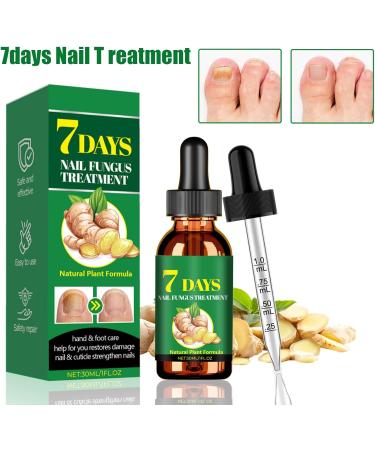  Generisch Nail Oil for Growth and Strength | Light Natural Nail Gel 30ml - Fortifying Care Gel - Natural Home Repair - Suitable for Family Stressed Nails - Buy Online on GoSupps.com
