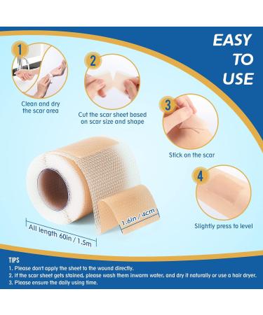 LONNIELONLI Silicone Scar Sheets - 2 Pack 1.6x60 Roll - Reusable Professional Scar Removal Tape for C-Section, Surgery, Burn, Keloid, Acne - Buy Online on GoSupps.com