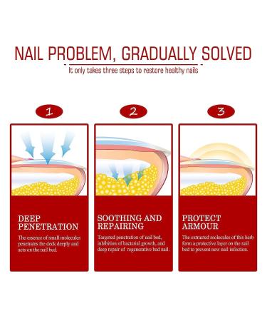 Onychomycosis Relief Oil - Rapid Toenail Repair & Ingrown Toenail Treatment (5 Sticks) - Improve Nail Health - Buy Online on GoSupps.com