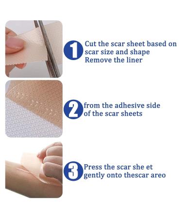 Silicone Gel Scar Patch for Stretch Marks, Burns & Cuts - Collagen Infused Skin Treatment - Buy Online on GoSupps.com