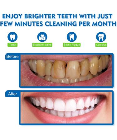 Liebsien Dental Cleaner Tool Kit for Adults - 5 Modes, IPX6, LED Screen - Oral Care Set - Buy Online on GoSupps.com