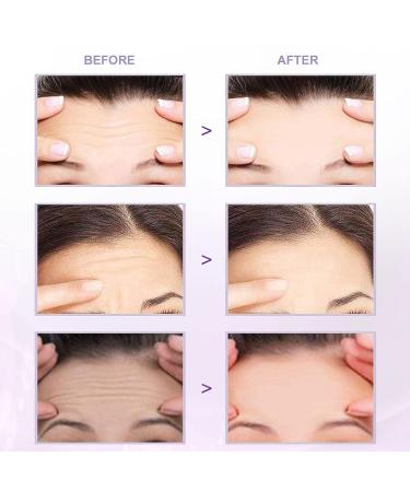 Forehead Wrinkle Patches - Anti-Wrinkle Facial Pads for Men and Women - 5 Count - Buy Online on GoSupps.com