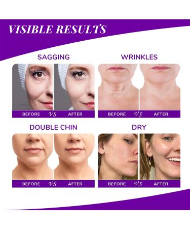 ANAI RUI ANAiRUi Cream for neck and d collet with Bakuchiol collagen and ceramide to reduce wrinkles necklines and sagging skin antiaging moisturizer 50 g NeckCream - Buy Online on GoSupps.com