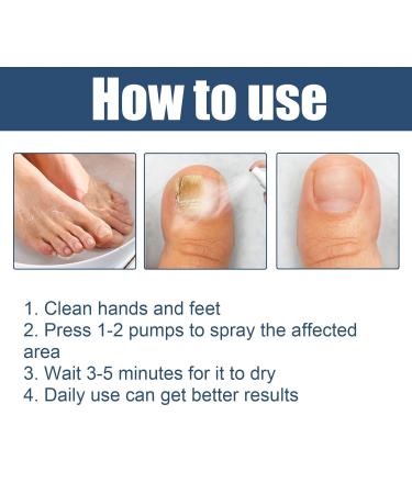 Furzero Medical Grade Nail Foot Spray - Foot Treatment Spray (1pc) - Buy Online on GoSupps.com