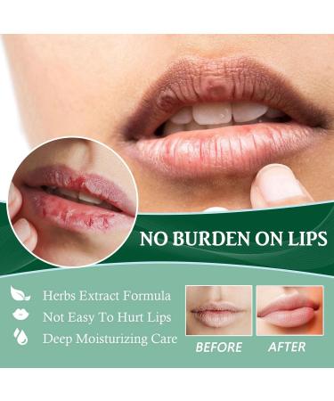 Mouth Ulcer Treatment Spray Mouth Ulcer Treatment for Adults Canker Sore Treatment Oral Care Spray Herbal Mouth Spray Canker Sores Relief Spray for Mouth Ulcer Bad Breath Treatment Mouth Freshener - Buy Online on GoSupps.com