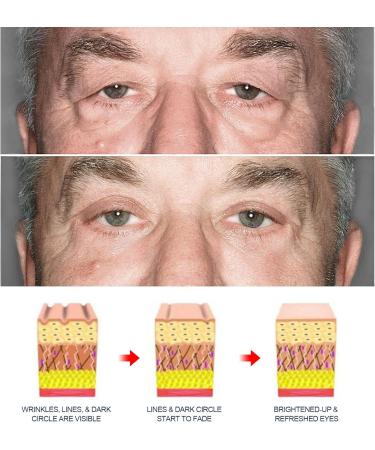 EKOKIM Innovative AntiPuffiness Cream Awaken Peptide Lifting Eye Gel MenS Moisturizing Eye Cream For Reduces PuffinessUnder Eye BagsWrinkles 3PCS - Buy Online on GoSupps.com