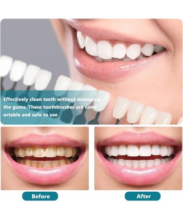 Healifty 4 Pcs Hard Denture Brush - Double Sided Toothbrush for Fake Teeth - Multi-Layered Bristles - Green - Buy Online on GoSupps.com