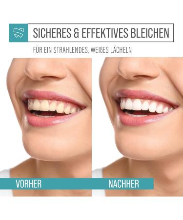 100% Natural Activated Carbon Powder for Teeth | 100g Coconut Tooth Whitening | Calcium Protection & Bleaching Toothpaste | Effective Activated Charcoal Whitening - Buy Online on GoSupps.com