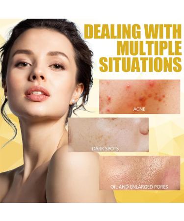 55 Turmeric Kojic Acid Pads Turmeric Cleansing Pads Turmeric Cleansing Pads Turmeric Face Scrub Pads Help Balance Oil Water Skin with 2 Wristbands - Buy Online on GoSupps.com