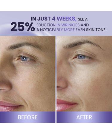 ABERA Belani Retinol Cream for Face Facial Moisturizer with Collagen and Hyaluronic Acid Anti-Wrinkle Reduce Fine Lines Night Anti-Aging Cream For Women (1.01 Fl Oz) (3 Boxes) - Buy Online on GoSupps.com