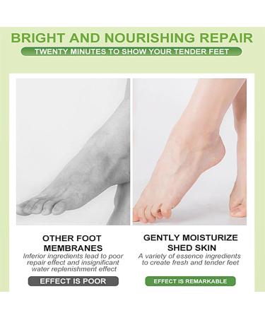 Moisturizing Foot Mask - 5 Pairs Exfoliating Peeling Socks for Dry Cracked Feet - Foot Spa Treatment for Men & Women - Buy Online on GoSupps.com