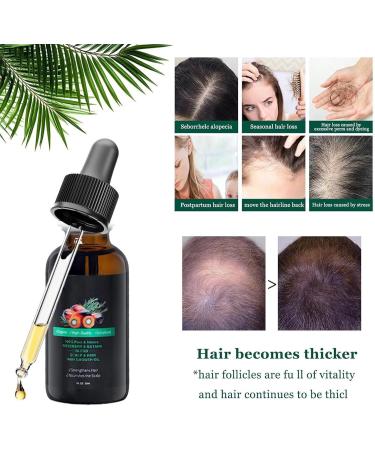 GkgWuxf Moisturizing Hair Oil Repairing Oil For Damaged Hair AntiFrizz Thickening Conditioner For Damaged Hair Oily Scalp Men Women - Buy Online on GoSupps.com