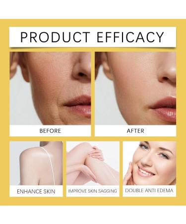 ARANYA Dual-Phase Capsule Depuffing Cream with Roselle Extract Hyaluronic Acid and Horse Chestnut Extract Firming and Lifting Skincare for Face and Body 1.76 oz - Buy Online on GoSupps.com