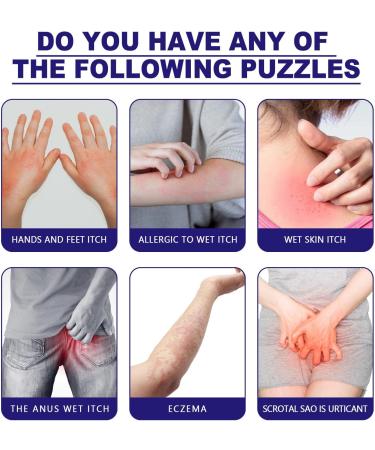 30g Herba Violae Natural Plant Anti-Itch Cream for Mosquito Bites & Skin Itch Relief - Buy Online on GoSupps.com