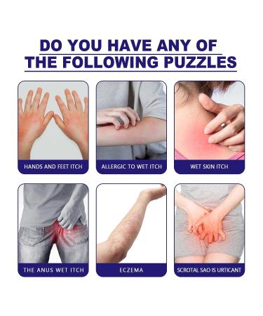 Anggrek Itch Relief Cream - Natural Plant Formula, 30g Ointment for Bites & Skin Itch - Buy Online on GoSupps.com