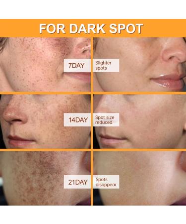 Vitamin C Moisturiser for Face Vitamin C Suspension 30% - Face Moisturiser to Nourish Skin Smooth Lines & Boost Glow Vitamin C Cream Day and Night Anti Aging Face Cream 1 oz/ 30 mL - Buy Online on GoSupps.com