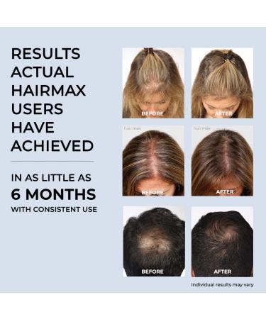 Hairmax ULTIMA 12 Classic Laser Comb for Hair Growth | FDA Cleared Treatment for Men & Women | Thinning Hair Solution for Denser, Fuller Hair | Spot or Full Scalp Growth Products - Buy Online on GoSupps.com