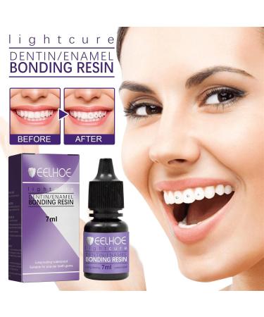 Tooth Jewelry Gemkit - Professional DIY Tooth Gemstone Kit for Stunning Tooth Decoration | Complete Teeth Gems Kit with Lamp & Glue - Buy Online on GoSupps.com