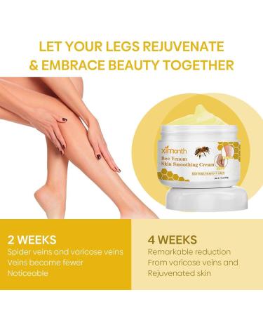 Furzero Bienengift Varicose Cream - Best Spider Vein & Pain Relief (2 Pieces) | Test Winner for Everyone - Buy Online on GoSupps.com
