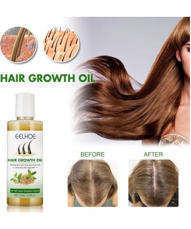 JITASHWA Hair Growth Oil Hair Growth Essence Repair Hair Follicles Hair Loss Prevention Hair Regrowth Treatment Hair Thickening Product - Buy Online on GoSupps.com