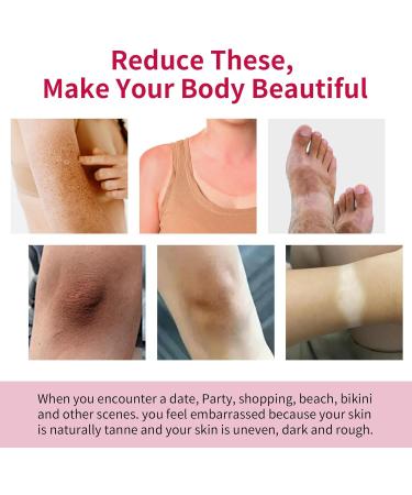 Ninnyi Armpit Cream for Thigh Knees Elbows Leg - Buy Online on GoSupps.com