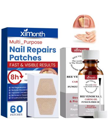 TaimeiMao 60 pieces nail digging repair patches 15 ml nail soft foot nails split nail repair strengthening nails nail digging repair patches for damaged nails and the appearance of