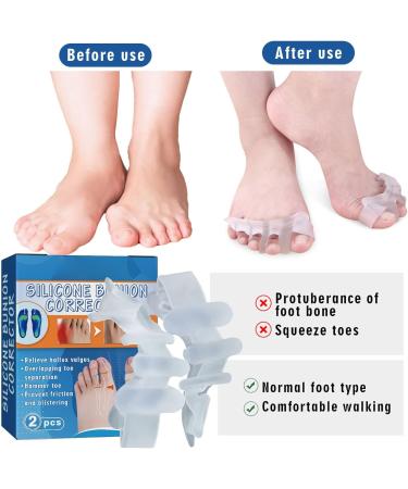 NPkgvia Gel Big Toe Bunion Guard & Protector | Toe Splitter Bunion Pad Corrector for Bent Toes Pressure | White One Size - Buy Online on GoSupps.com
