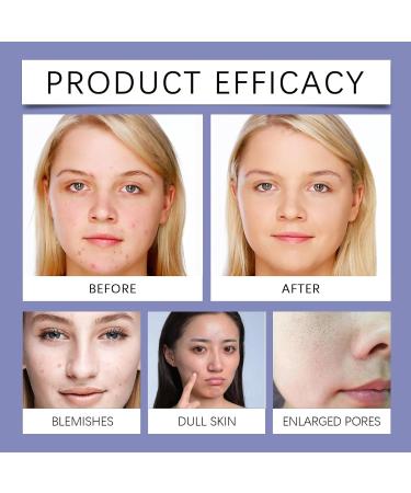 Gentle Facial Cleanser - Deep Pore Cleansing Acne-Fighting Oil-Control Hydrating Non-Tightening For Healthy Skin Glow(3PCS) - Buy Online on GoSupps.com