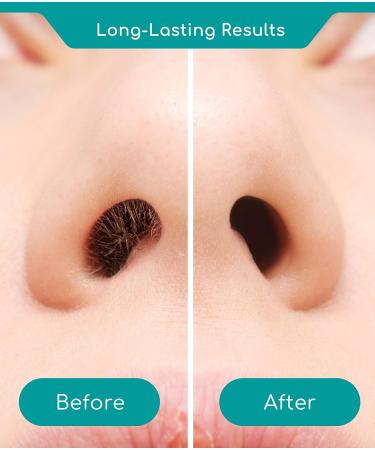 Medi Grade Nose Waxing Kit 50g - Eco-friendly Nose Hair Remover for Men and Women - Includes Reusable Wax Sticks and Microwavable Cup - Unsightly Nasal Hair Removal Solution - Buy Online on GoSupps.com